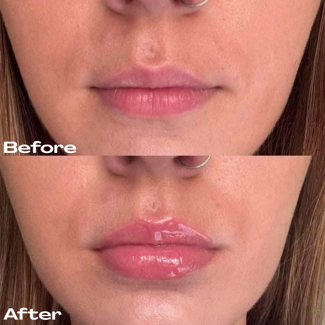 Extreme Lip Plumper