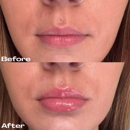 Extreme Lip Plumper