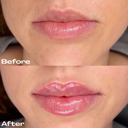 Extreme Lip Plumper